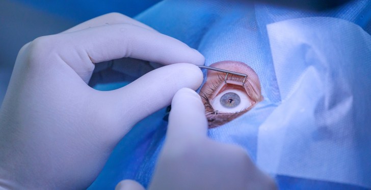 Doctors Warn About LASIK Surgery After Police Officer Kills Himself Over Side Effects