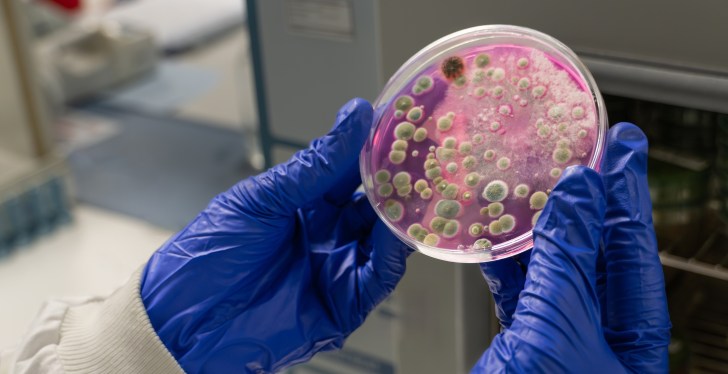 Deadly Fungus That Could Eat Your Lungs Spreads To America