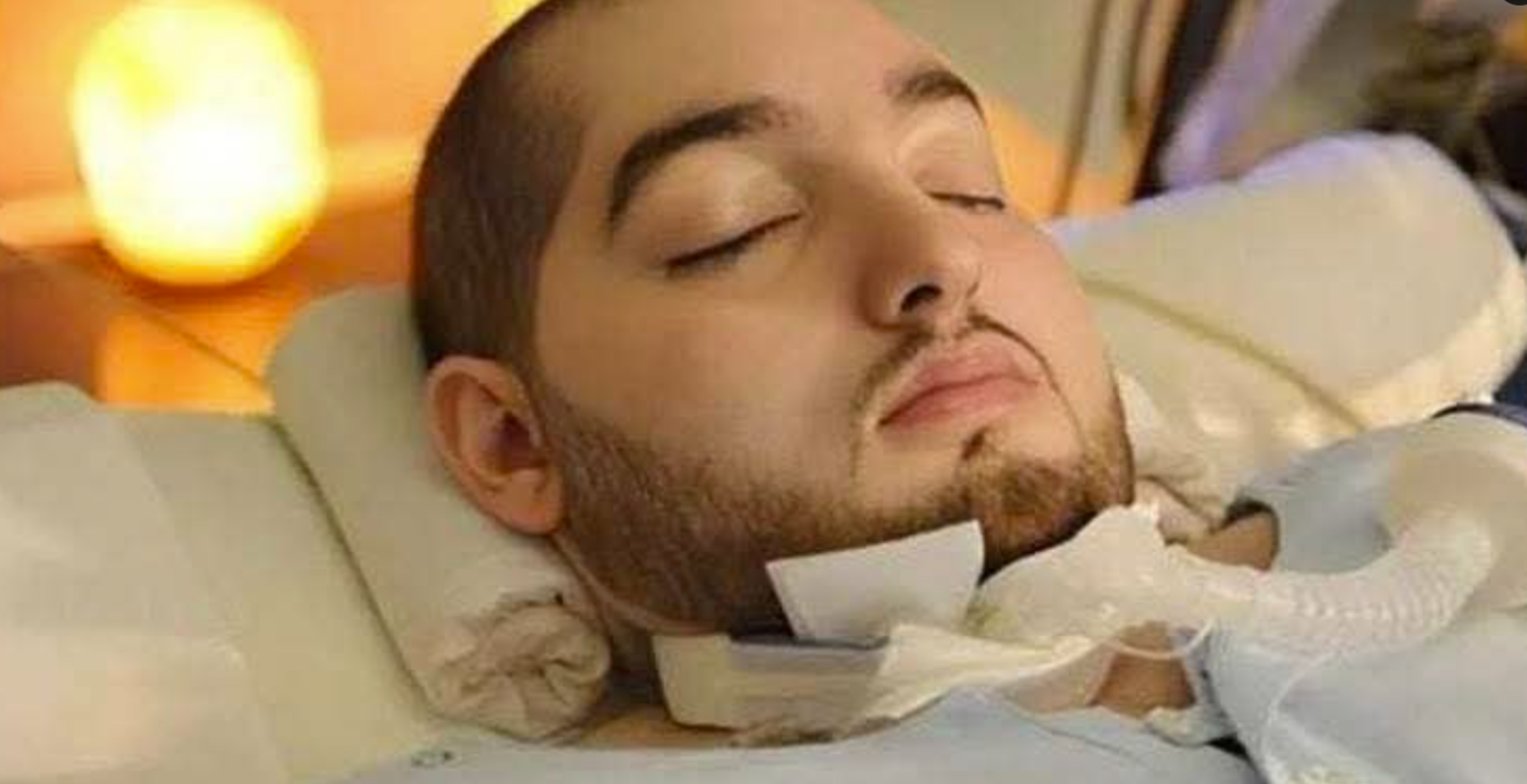 Man Dies After Spending 20 Years In A Coma