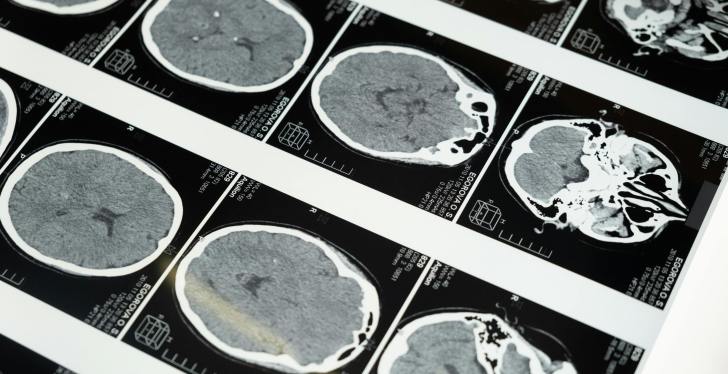 Parasite Could Have Infected Up To 30% Of Americans, According To Study