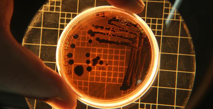 Woman Dies After STD Spreads Throughout Her Organs